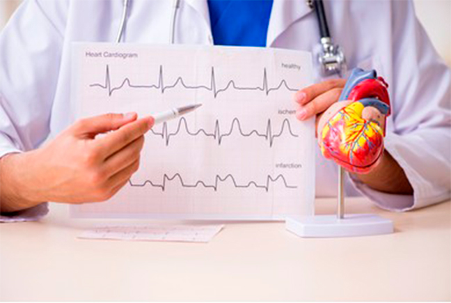 Check-up do coração: quando fazer e com que frequência?